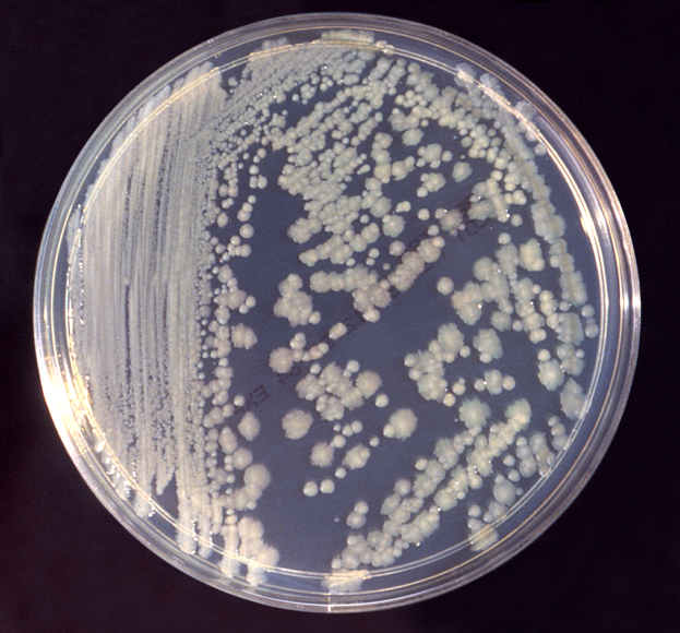 Enterobacter Aerogenes Gram Stain