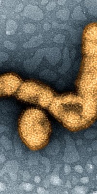 H1N1_Influenza_Virus_Particles_(8414750984)