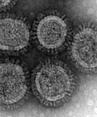 H5N1_Virus_small