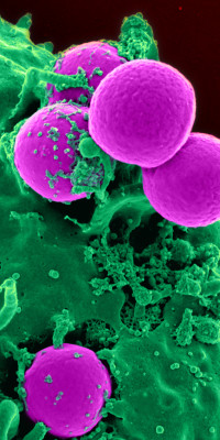Human_neutrophil_ingesting_MRSA Human_neutrophil_ingesting_MRSA