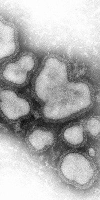 Influenza_A_virus_-_negative_stain_image_TEM