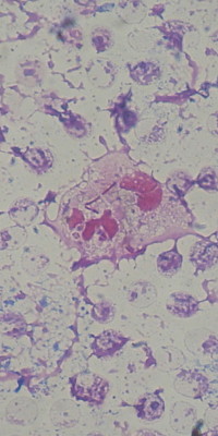 Pseudomonas aeruginosa (bastonete Gram negativo)
