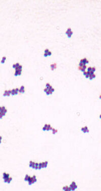 Staphylococcus_aureus_Gram