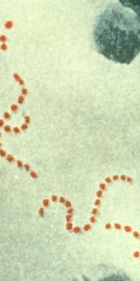 Streptococcus_pyogenes