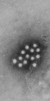 Hepatitis A - Electron Micrograph

Electron micrograph of Hepatitis A virus.

1976

Betty Partin

tray #2, B77-764