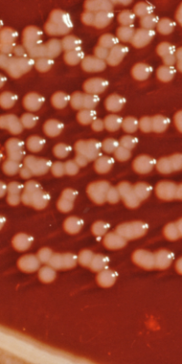 Yersinia_enterocolitica_01